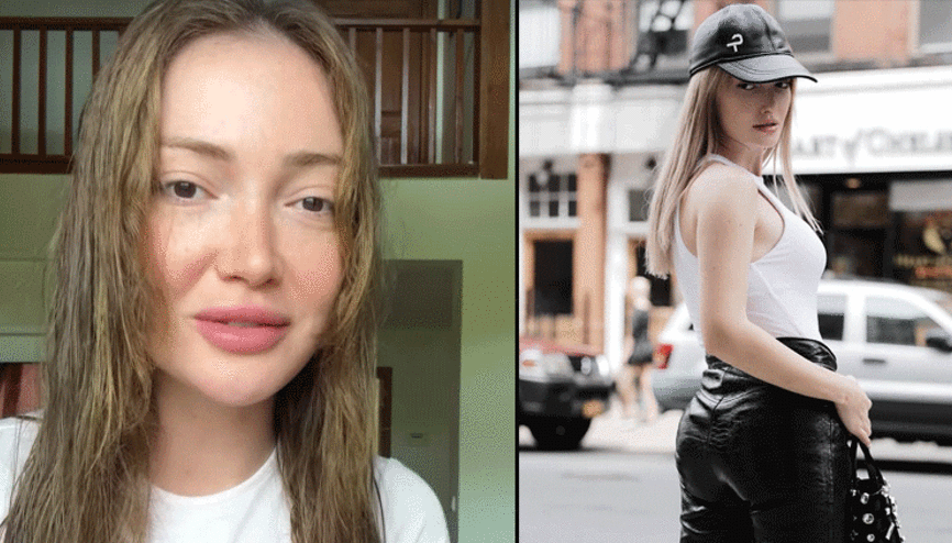 Kalça dolgusu kaburgasına çıktı... Danla Biliç doktorunu suçladı