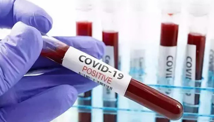 ABDde COVID-19 ölümleri arttı: Her hafta 300 kişi hayatını kaybediyor