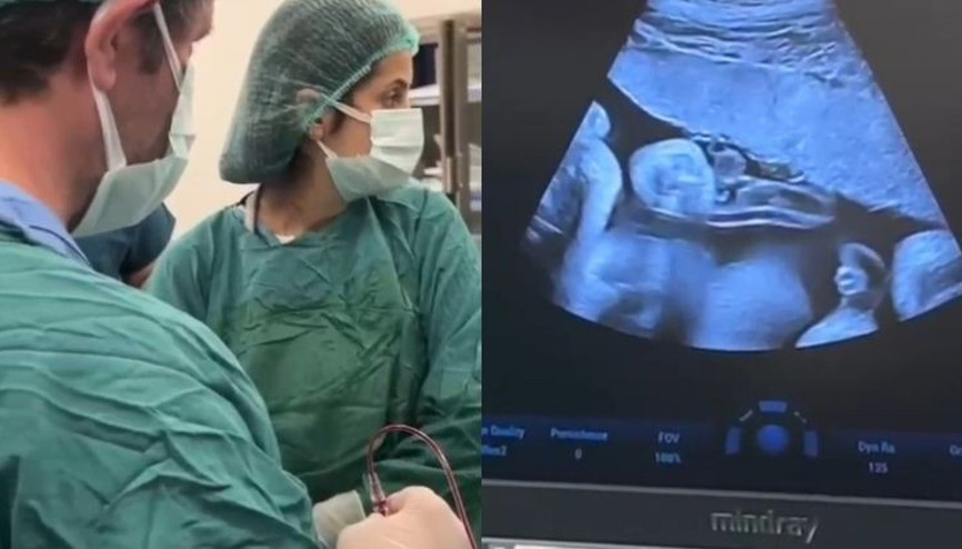 Anne karnındaki bebeğe kan nakli yapıldı