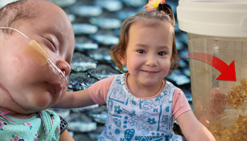 Prematüre doğdu, 131 gün yoğun bakımda kaldı. Hayatını balık derisi tedavisi kurtardı | Ona küçük denizkızım diyorum