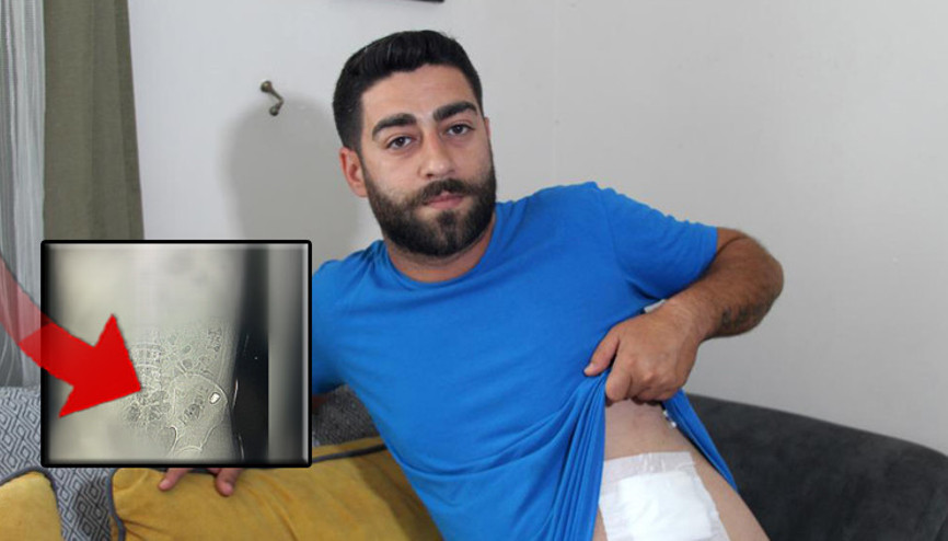 Karnında hissettiği ağrıyla hastaneye gitti, gerçek çekilen röntgenle ortaya çıktı