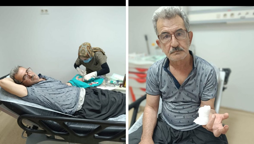 Karpuz keserken parmağını kesti