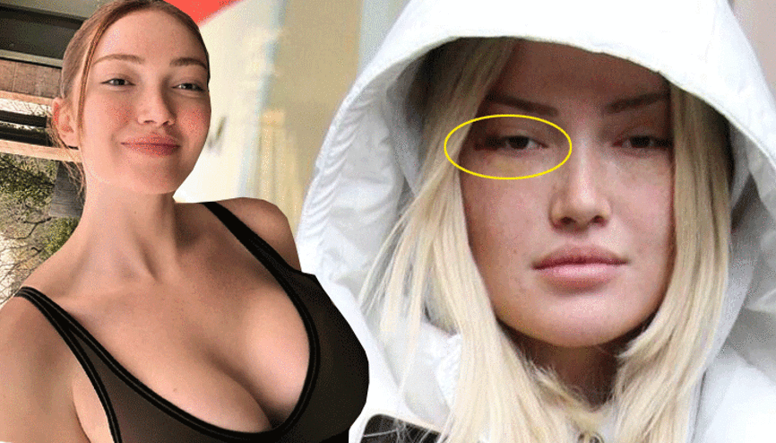 Estetik operasyonları için ne kadar harcadı Danla Bilic ilk kez açıkladı