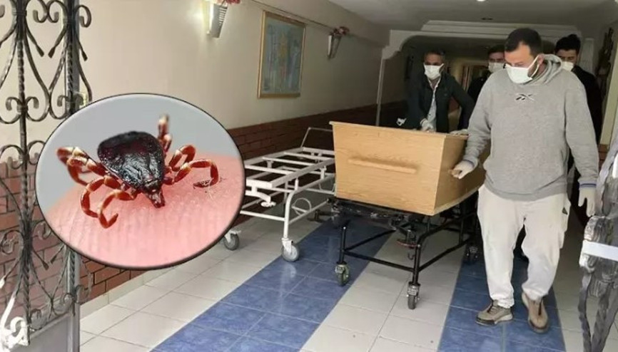 Sivas’ta kene kâbusu: Tedavi gören bir kişi daha hayatını kaybetti