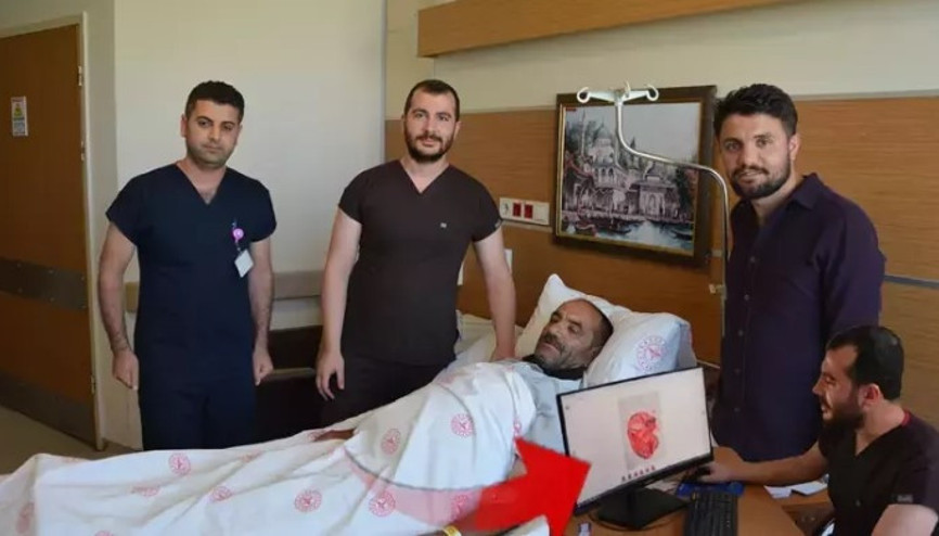 Karın şişliği için hastaneye gitti, böbreğinden 23 santimetrelik kist çıkarıldı