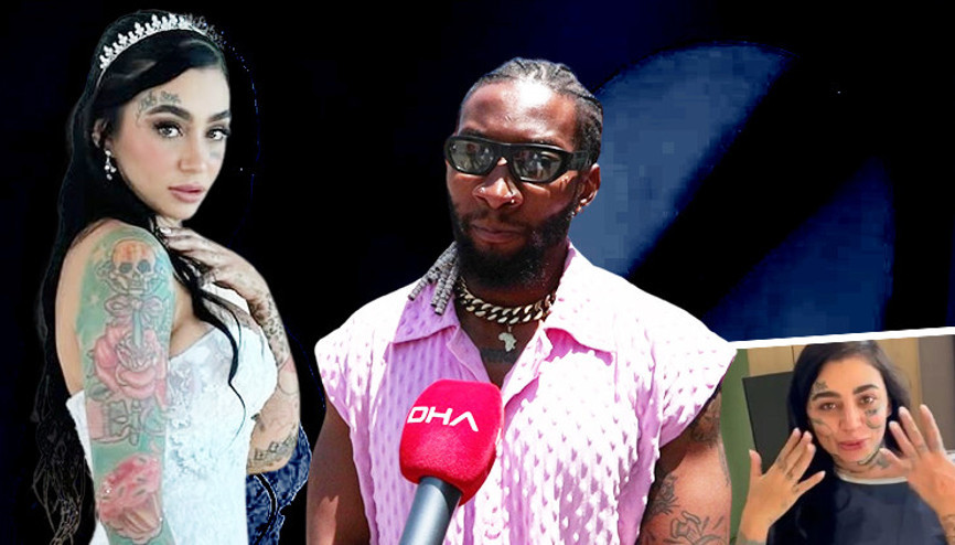 Reklam anlaşmalı estetikte acı son... İstanbulda özel hastanedeki operasyon sonrası ölüm Mozambikli sanatçı: Adalet istiyorum