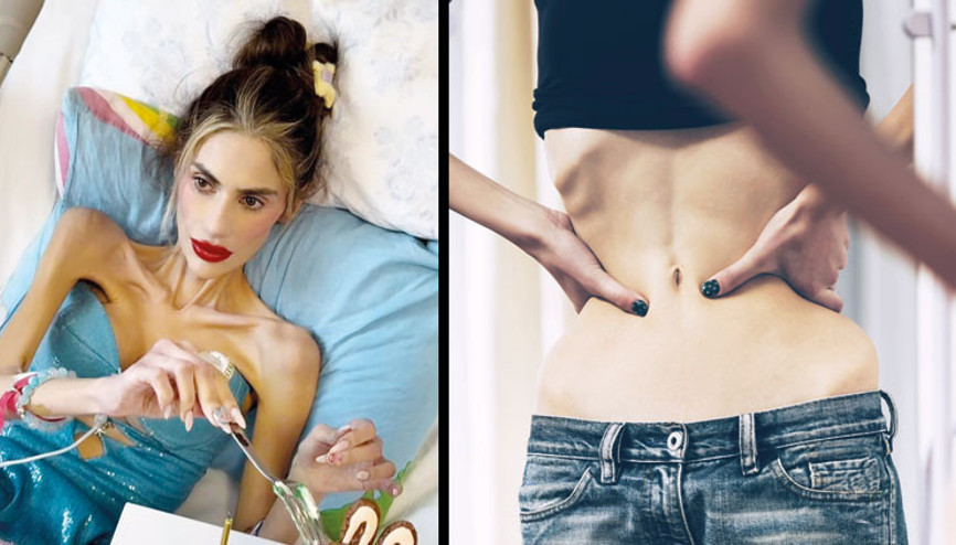 Yeme bozukluğunda sosyal medya tehdidi