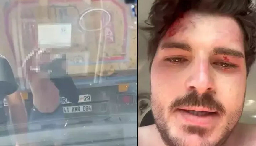 4 kişinin trafikte darbettiği oyuncu: Öldürene kadar döveceklerdi