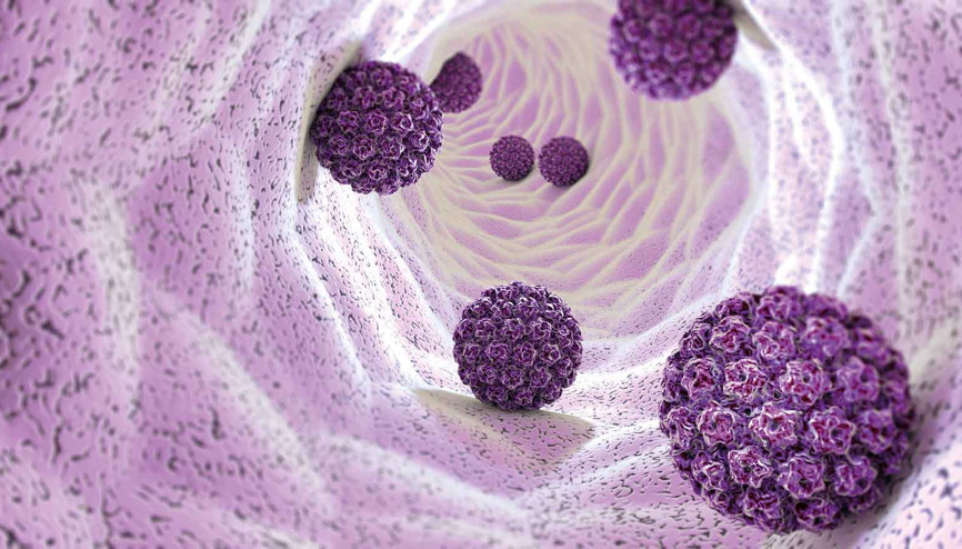 Her 2 erkekten 1’i yakalanıyor... HPV sanılandan daha tehlikeli