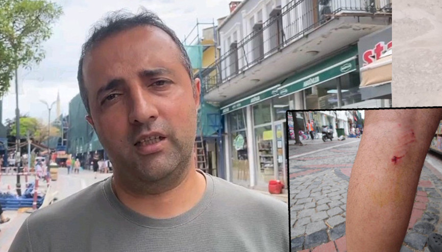 Edirnede bir vatandaş 8 köpeğin saldırısına uğradı