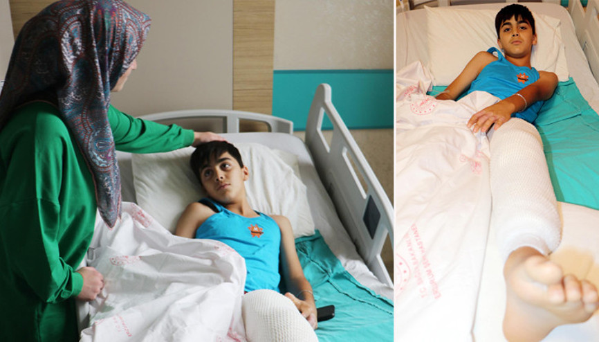 Şaka yaparken arkadaşını yaktı