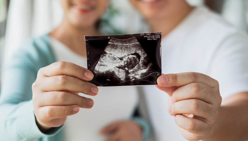 18 yıl boyunca çocuk sahibi olmak için her şeyi yapmışlardı.. Yeni bir teknoloji sayesinde imkânsız görülen gerçek oldu: Bebek aralık ayında geliyor