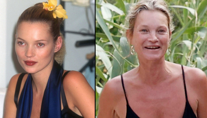 Hızlı hayatın izleri yüzünde gizli