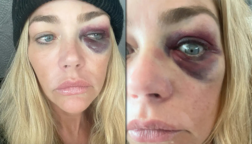 Altı yıllık evlilikleri geçen hafta bitmişti… Ünlü oyuncu polise gitti: Kocam beni öldürmeye çalıştı