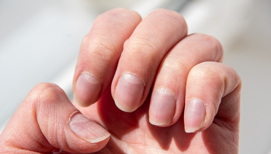 Sağlıklı cilt ve güçlü tırnaklar için bilmeniz gerekenler