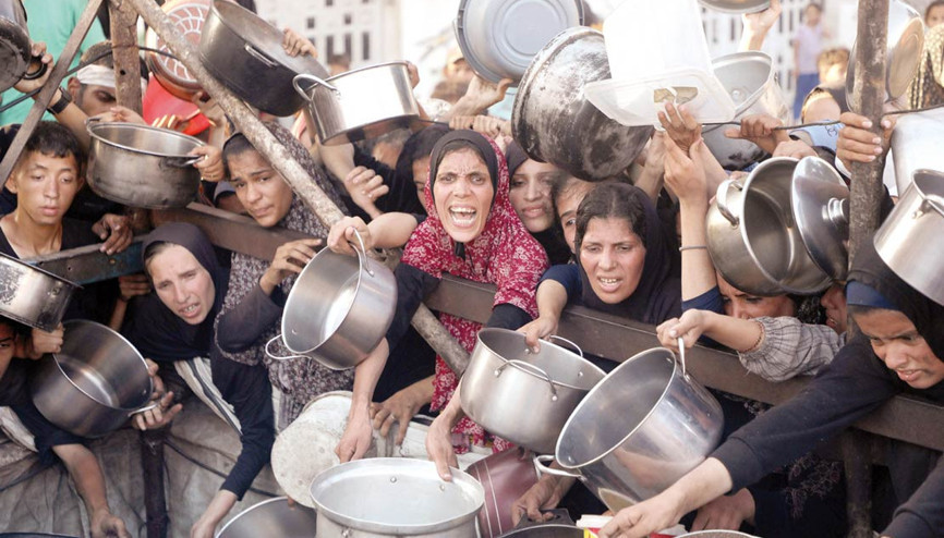 Gazzeli doktor anlatıyor… Çocuklar ‘bir deri bir kemik’ kaldı