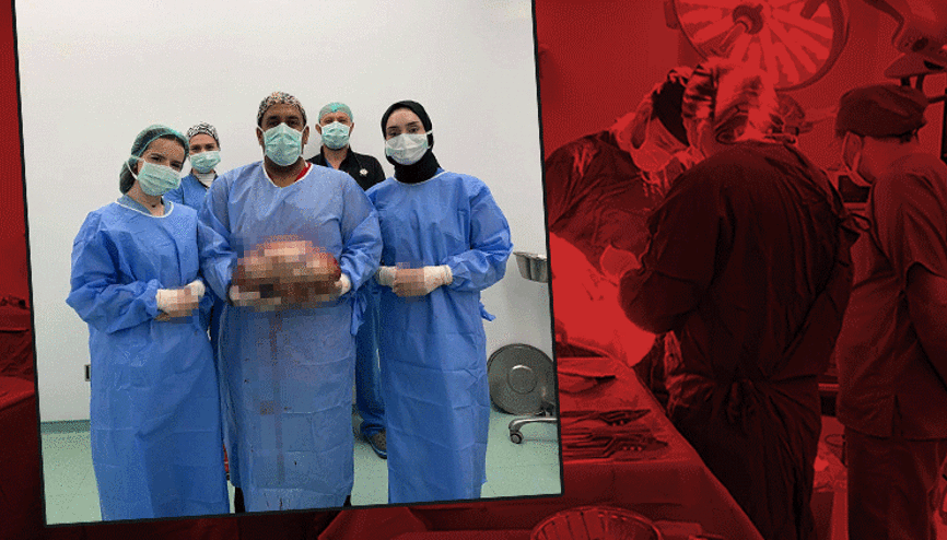 Adeta hamile bir kadın gibi hareket ediyordu... Şişlik sebebiyle gitti karnından çıkan şok etti Adeta hamile bir kadın gibi hareket ediyordu... Şişlik sebebiyle gitti karnından çıkan şok etti