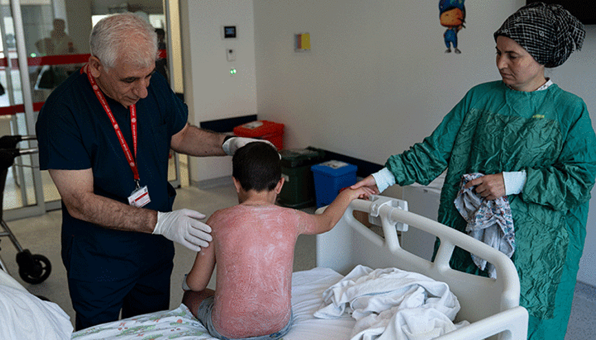 Küçük çocuk 4 saat güneşte kaldı hastanelik oldu