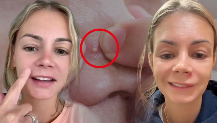 Dikkat: Hayatınıza mal olabilir: ‘Ölüm Üçgeni’ gerçekten var ‘Birkaç saat içinde her şey kötüye gitti, acile kaldırıldım’