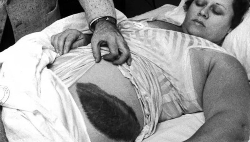 Tarihe geçen olay: Meteorun çarptığı tek insan