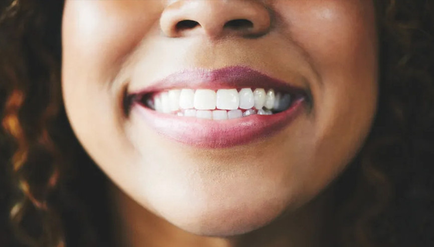 Tıpta devrim: Diş çürükleri koyun yünüyle önlenecek