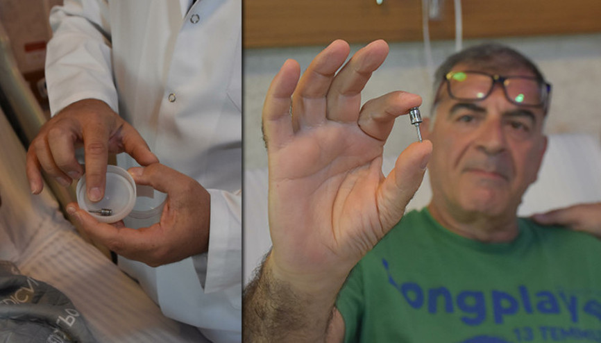 Akciğerinden çıkana inanamadı Doktorlar şaşkına döndü: Genelde çocuklarda görülüyor, ilginç bir olay