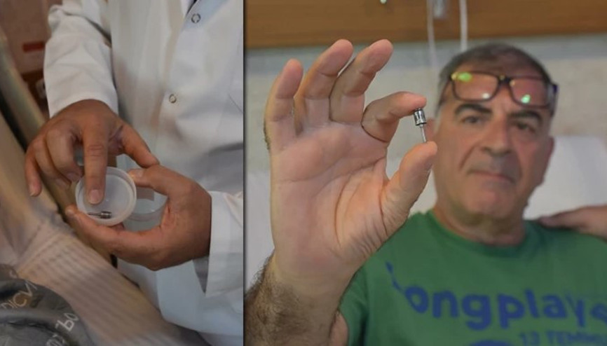 Akciğerinden diş implantı çıktı Akciğerinden diş implantı çıktı