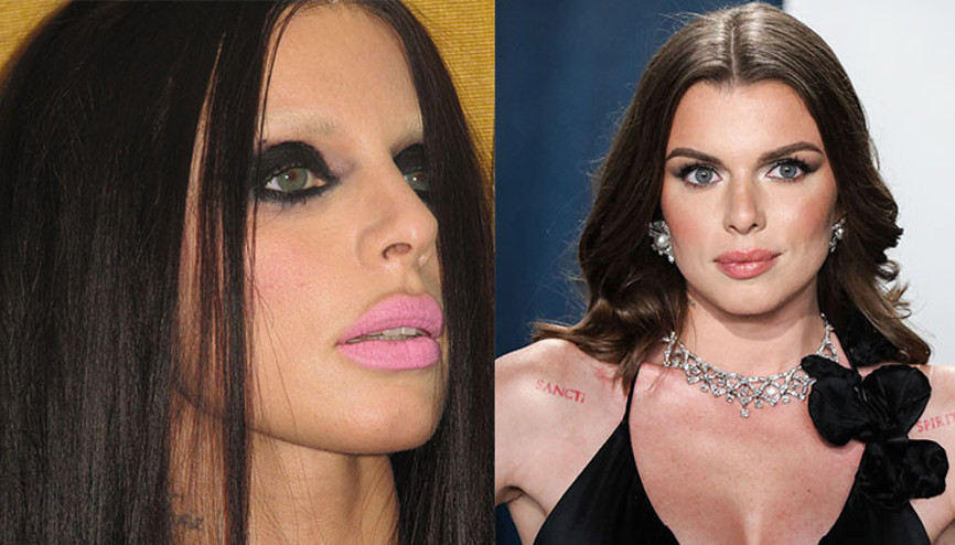 ‘Keşke eski halime geri dönebilsem’ Estetiklerden sonra bambaşka birine dönüşmüştü… Erkekler uğruna yaptıklarından pişman oldu