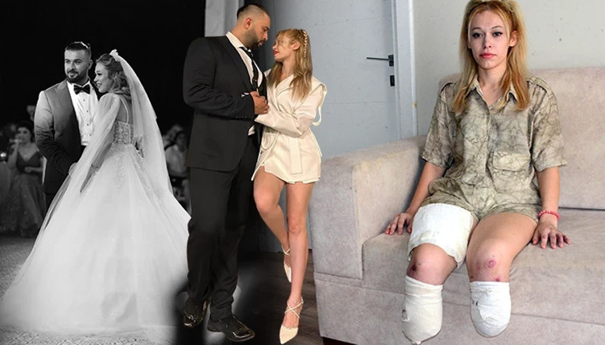 Evlilik yıl dönümünde bacaklarını kaybetti