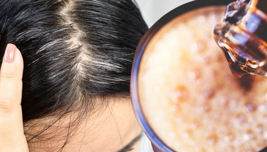 Beyazlayan ve dökülen saçlarınızın nedeni bu iki içecek olabilir