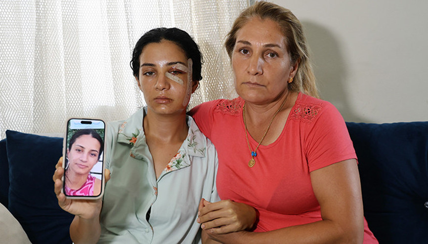 Anneye imdat mesajı: Öldürdü bu beni | Önce kabusu yaşattı sonra hastaneye götürdü... Gözü dönmüş eski eş serbest kaldı