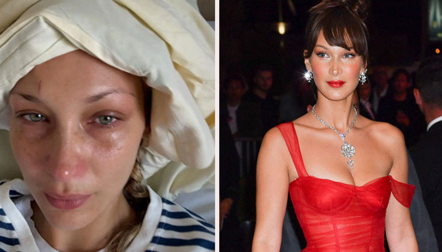 Güzelliği ve milyonları olsa neye yarar... Sağlığı çoktan gitti... Bir hastane odasında çaresiz hastalığıyla baş başa