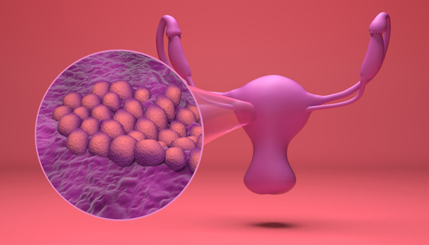 Her kadın 21 yaşından sonra bu testi mutlaka yaptırmalı Dünyada her yıl yaklaşık 1.5 milyon kadın jinekolojik kanserle mücadele ediyor