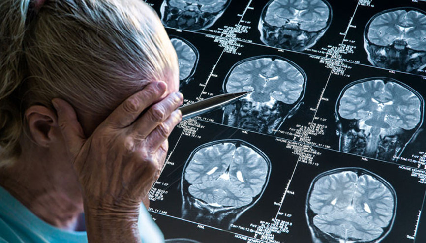 Alzheimer tarih mi oluyor Bu yıl öğrendiğimiz şaşırtıcı derecede umut veren beş şey Alzheimer tarih mi oluyor Bu yıl öğrendiğimiz şaşırtıcı derecede umut veren beş şey