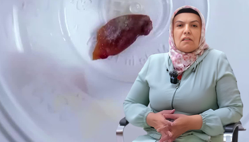 1 buçuk yıldır öksürüyordu, hastanedeki kontrolde şoke eden gerçek ortaya çıktı