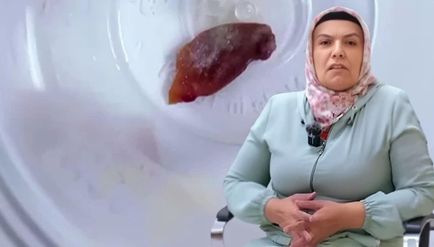 1 buçuk yıldır öksürüyordu, hastanedeki kontrolde şoke eden gerçek ortaya çıktı