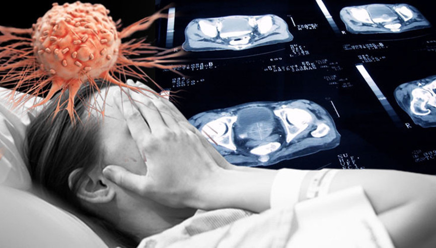 Küresel kanser patlaması yaşanacak 2050ye kadar ölümlerin %75 artması bekleniyor... Türkiye’de durum ne