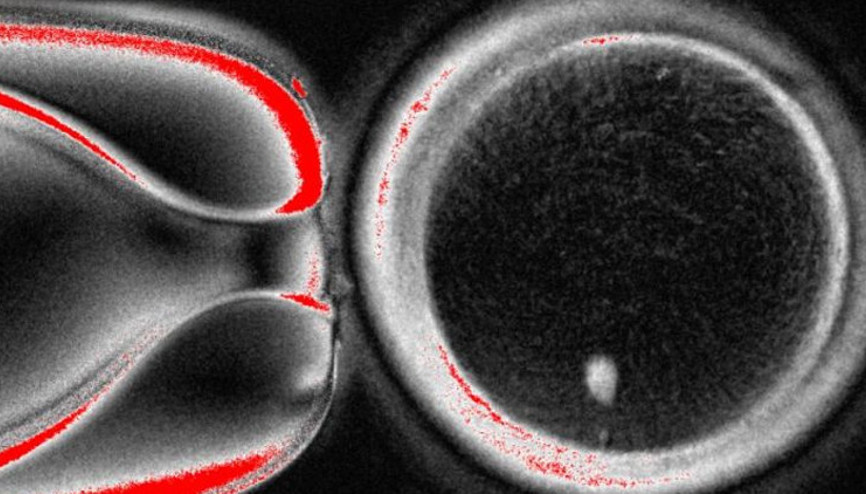 Bilim dünyasında çığır açan gelişme: Deri hücresinden yumurta hücresi üretildi Bilim dünyasında çığır açan gelişme: Deri hücresinden yumurta hücresi üretildi