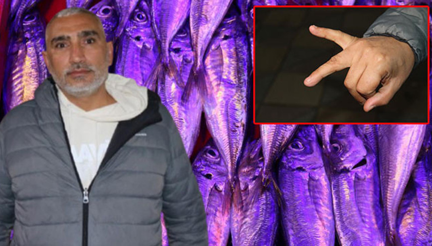 Balıkçıyla kavga eden müşteri çuprayla dövüldü, eli kırıldı