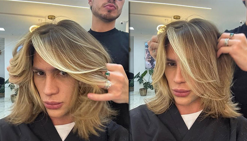 Daha 31 yaşındaydı… Ünlü fenomen ‘tilki gözü’ operasyonundan sonra hayatını kaybetti