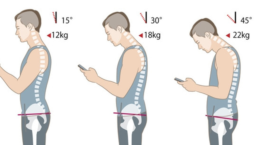 Omurlara 22 kg ekstra yük biniyor Gündüz yaptığınız bu hata gece sizi uykusuz bırakıyor