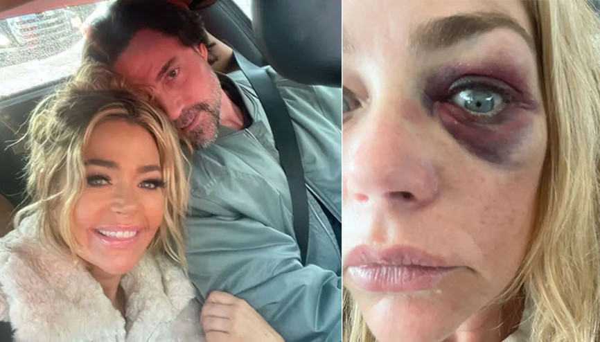 Ayrıldığı kocasından gördüğü şiddeti gözyaşlarıyla anlattı… ‘Beni hayat kadınlarıyla aldatan eşim hiç senin kadar alçalmadı’