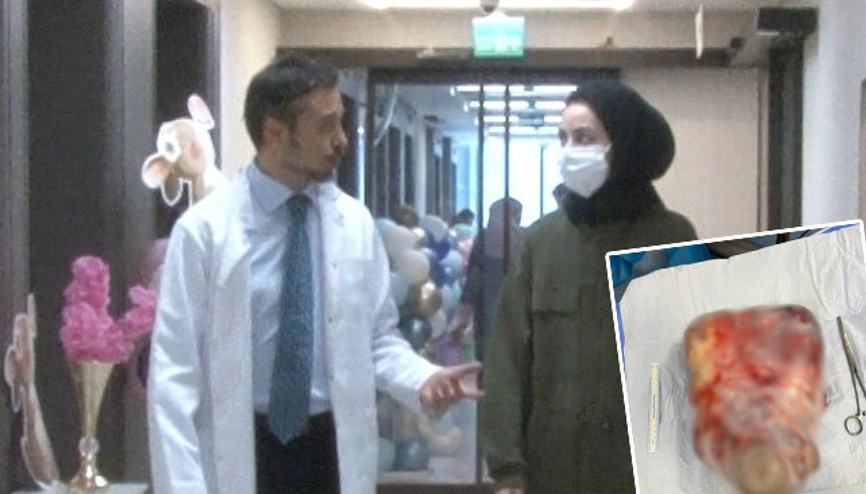 Karnındaki şişliği gaz sandı, hastaneye gitti 5 kiloluk kist çıktı