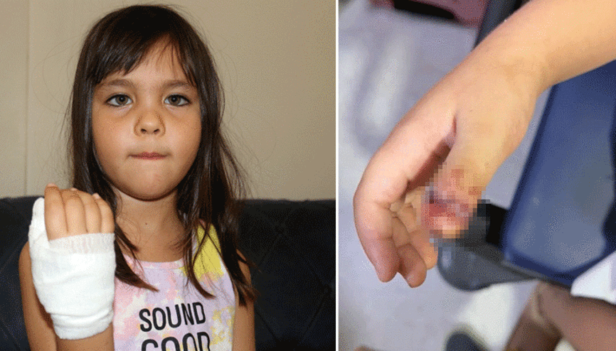 Antalyada anaokulunda korkunç olay 4 yaşındaki çocuğun parmağı, demir kapıya sıkışarak koptu