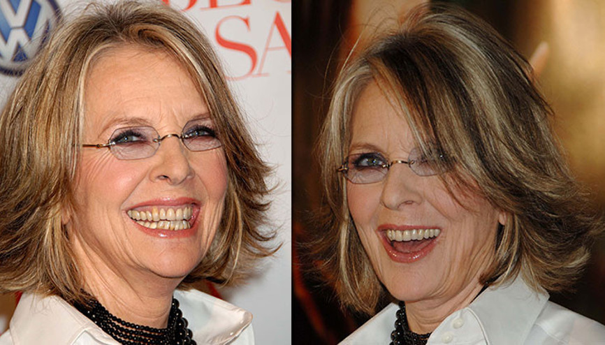 Dünya bu gülüşe hayrandı… Hiç evlenmedi, kendiyle baş başa yaşlandı… Ömrünün son 35 yılını aşksız yaşayıp bu dünyadan göçtü...