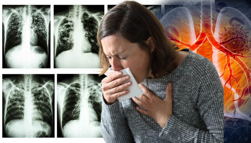 Covid ve grip ile karıştırılıyor, çok çabuk bulaşıyor: Ölümcül hastalık geri döndü Uzmanlardan kritik uyarılar...