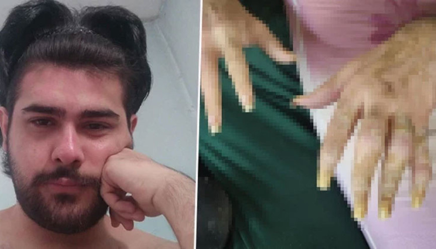 3 yıldır evden dışarı çıkmıyor, tırnaklarını kesmiyordu Eski hali ortaya çıktı 3 yıldır evden dışarı çıkmıyor, tırnaklarını kesmiyordu Eski hali ortaya çıktı