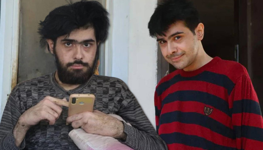 3 yıl sonra duş alıp dışarı çıkan Barışa teşhis kondu: Tedaviye başlandı | Barışı sosyal hayata ailesine kazandırmaya çalışacağız 3 yıl sonra duş alıp dışarı çıkan Barışa teşhis kondu: Tedaviye başlandı | Barışı sosyal hayata ailesine kazandırmaya çalışacağız