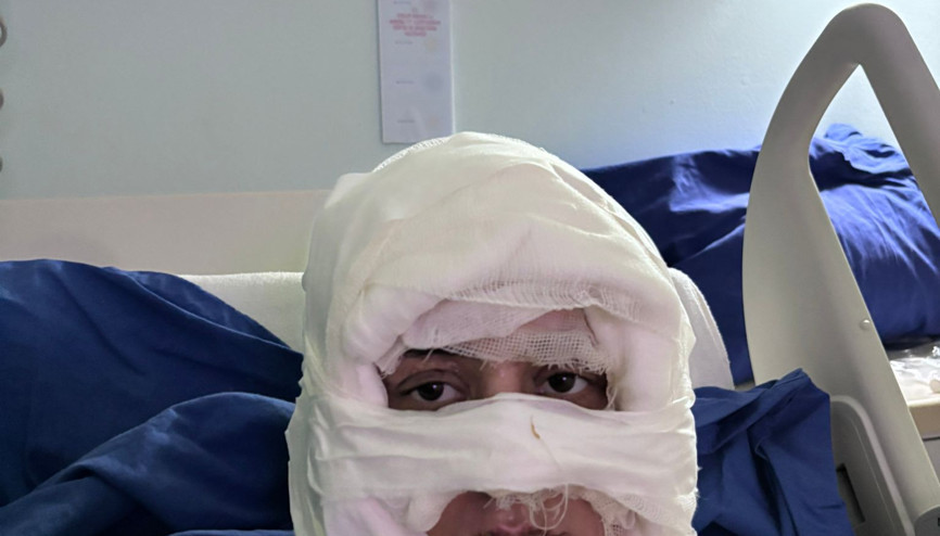 İstanbul - Kadıköyde bir kadın, üzerine yanıcı madde dökülerek ateşe verildi İstanbul - Kadıköyde bir kadın, üzerine yanıcı madde dökülerek ateşe verildi