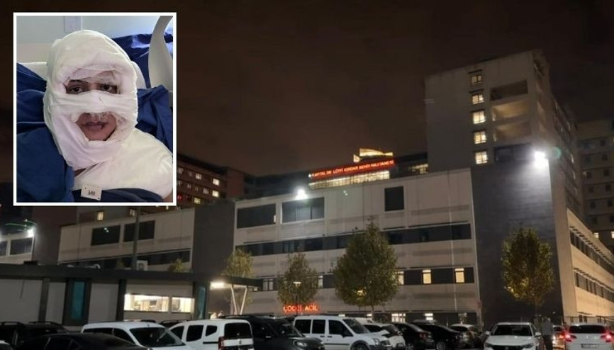 Ölümden döndü... Kadıköyde sokak ortasında ateşe verildi